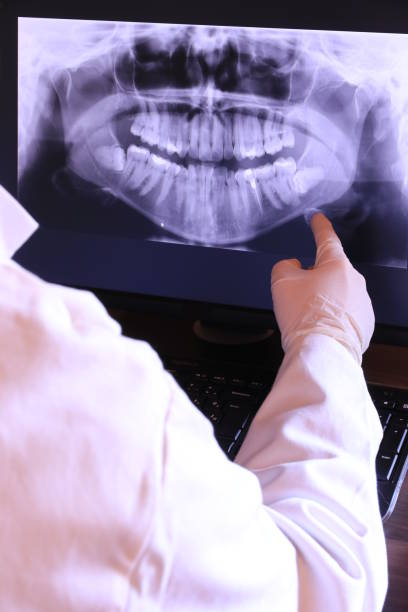Best Emergency Tooth Extraction in Shadeland, IN