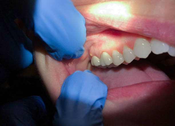 Best Emergency TMJ Treatment in Shadeland, IN